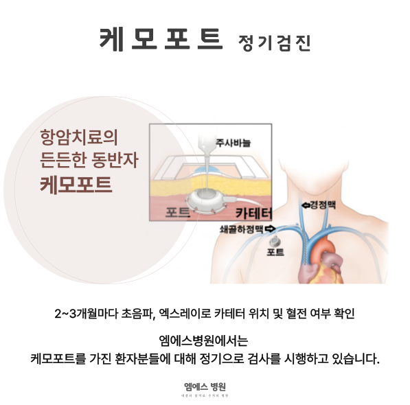 케모포트 정기검사